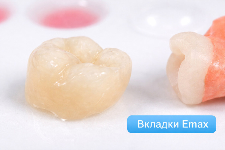 Вкладка восстановительная E-MAX